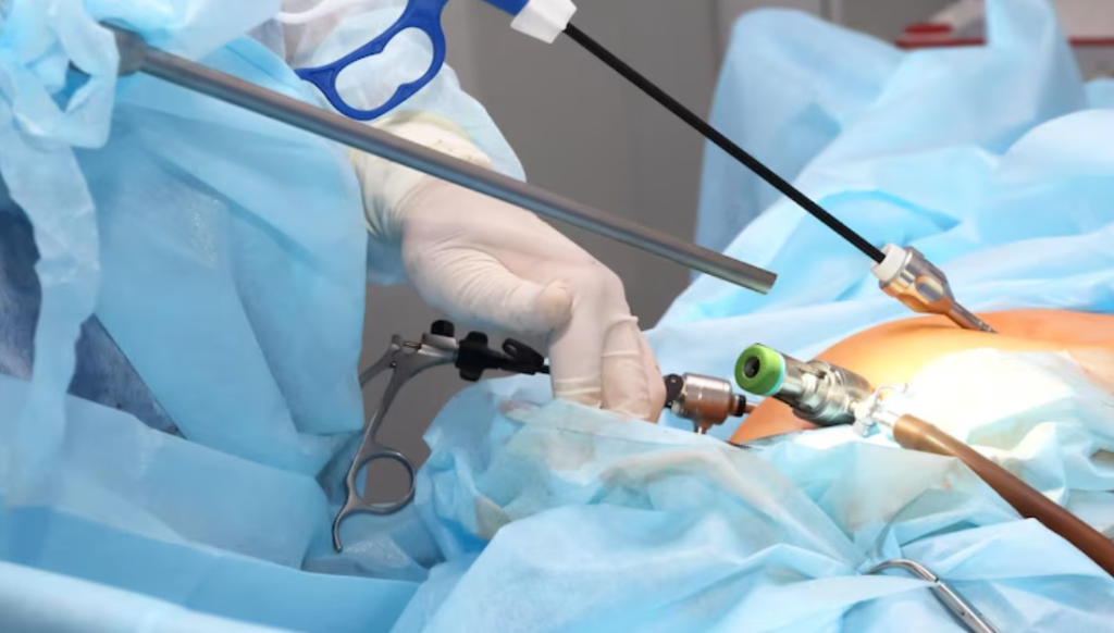 Best Paediatric Laparoscopic Surgeon in Kolkata
