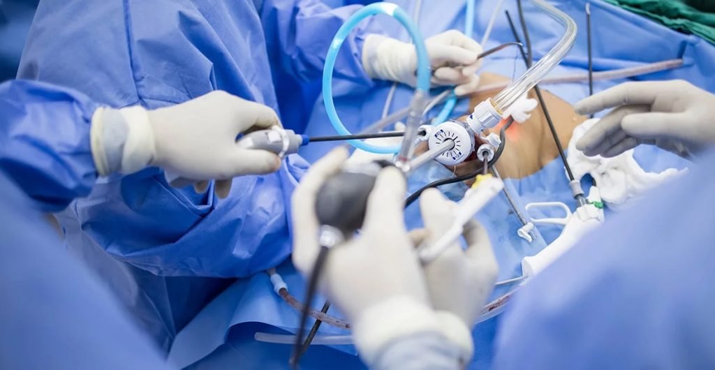 laparoscopic pediatric surgery in Kolkata